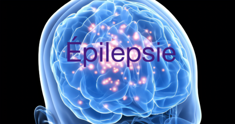 Les Cannabinoïdes dans le Traitement de l’Épilepsie